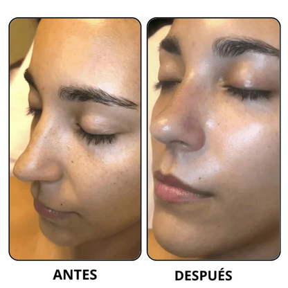 Korean Peel Shot – Removes impurities and enhances your skin